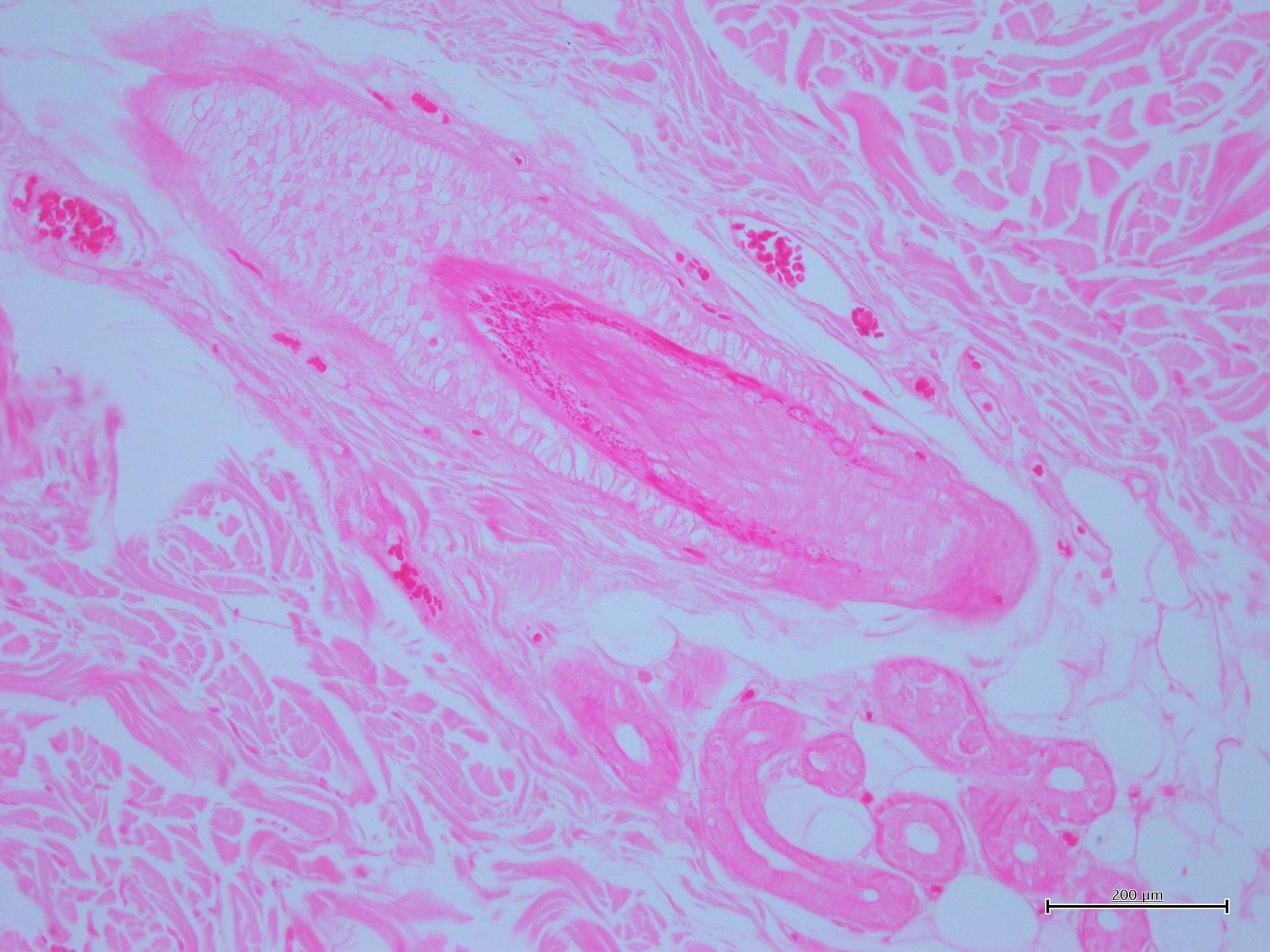 Eosina G o Y alcolica 0,5%