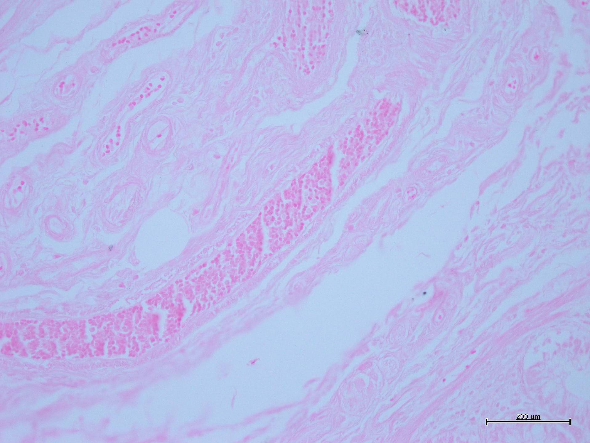 Eosina G o Y policromatica acquosa 1%