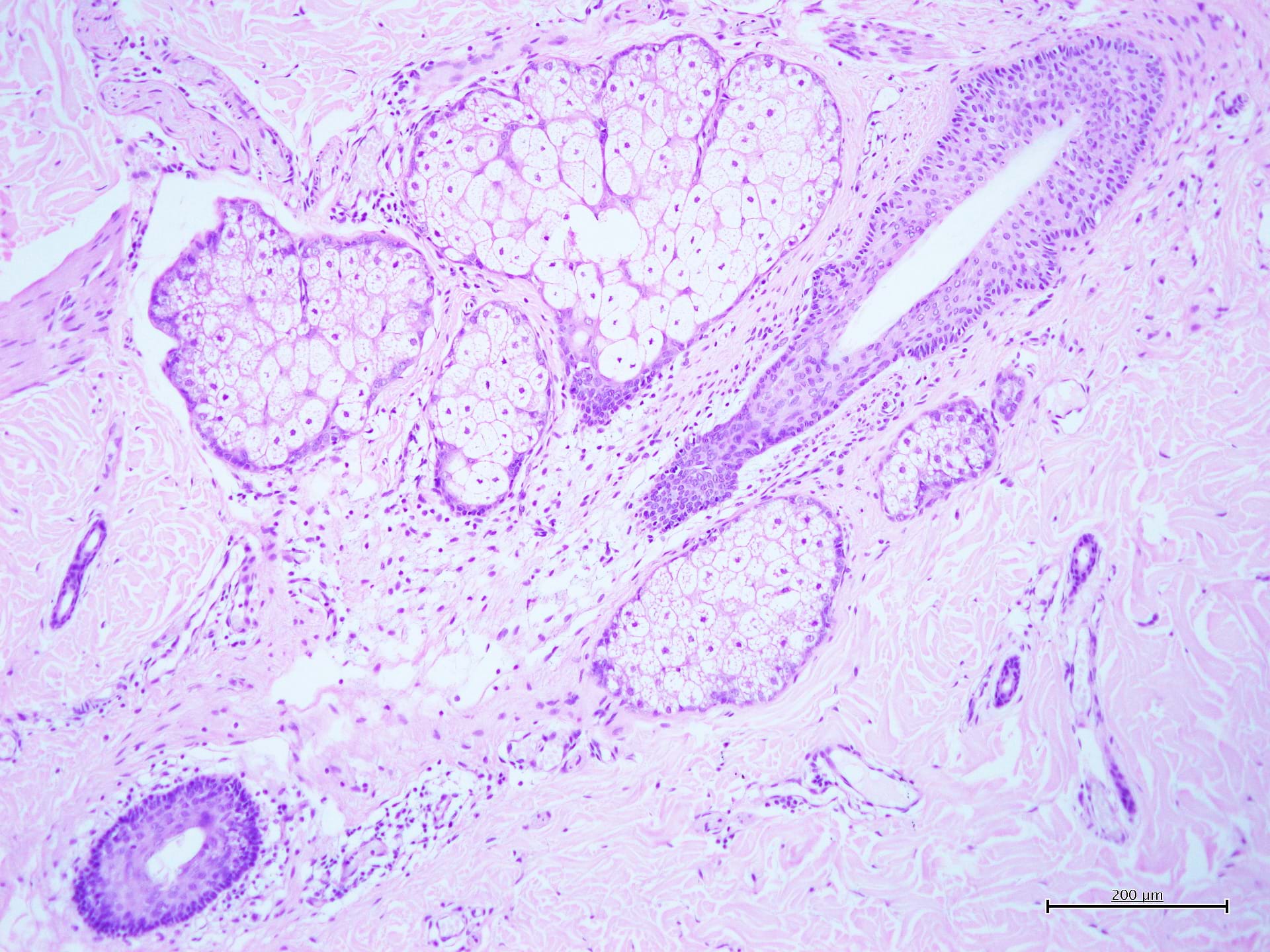 Ematossilina<br />di Carazzi