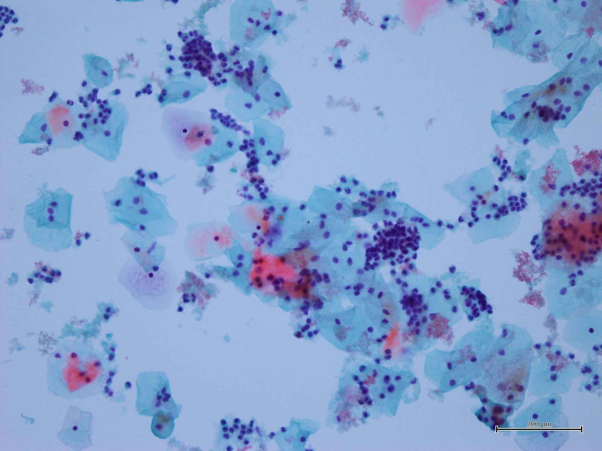 Ematossilina Gill II