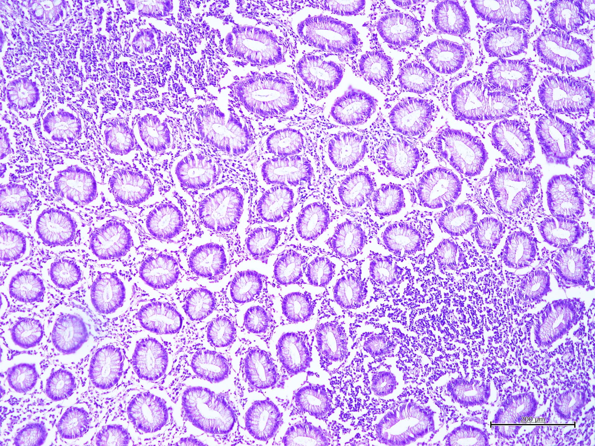 Ematossilina Gill III